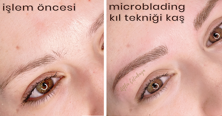 Microblading Nedir? Kıl Tekniği Kaş Nasıl Yapılır?